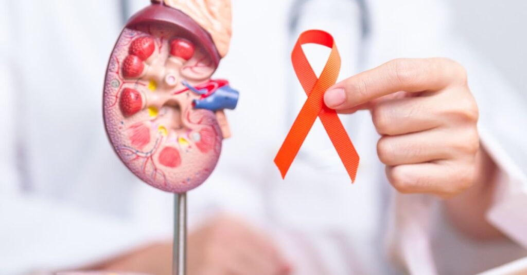 kidney cancer treatment in indore