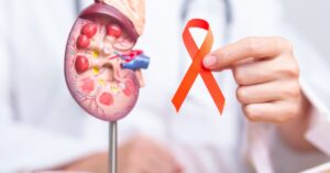 kidney cancer treatment in indore