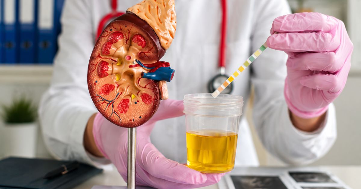 urosurgeon in Indore